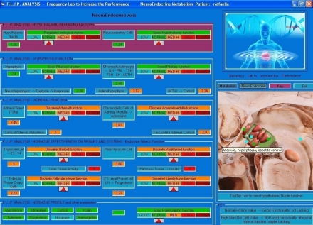 F.L.I.P. Analysis – Frequency Lab to Increase the Performance - farmaxiaonline.com